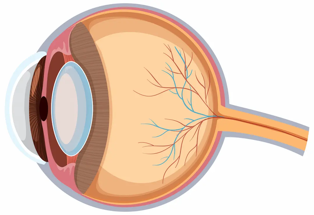 Diabetic Retinopathy Care in Patna: Signs, Prevention and Treatments Diabetic Retinopathy Care in Patna: Signs, Prevention and Treatments