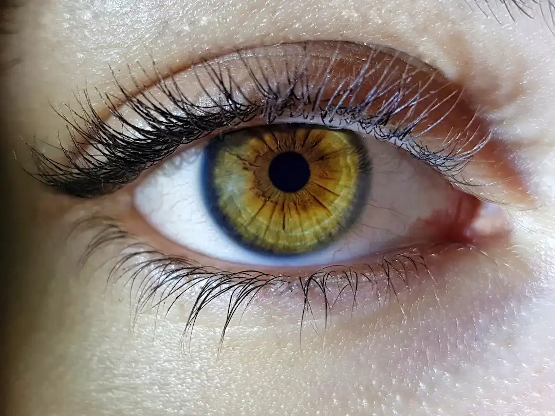 Glaucoma Screening & Treatment in Patna